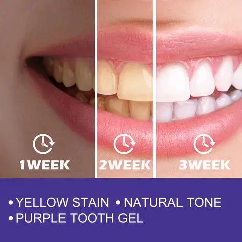 HISMILE PURPLE WHITENING TOOTHPASTE STAIN REMOVAL